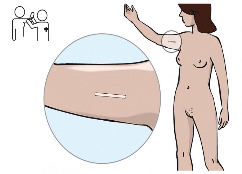 Wie eine plastische Operation der Brust der Frauen machen